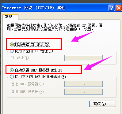 本地連接 本地連接