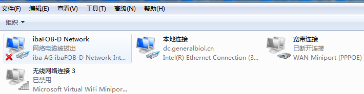 電腦看不到本地連接